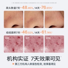 海龟爸爸双萃控油祛痘洁面乳80g  6976042261072