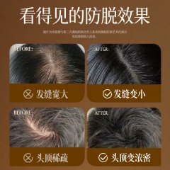 卓蓝雅生姜防脱洗发水400ml+防脱精华液50ml（10号 镇店款）