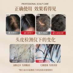 卓蓝雅生姜去屑洗发水400ml+生姜防脱精华液50ml